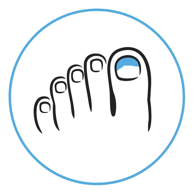 ikona paznokcie ze zmianami